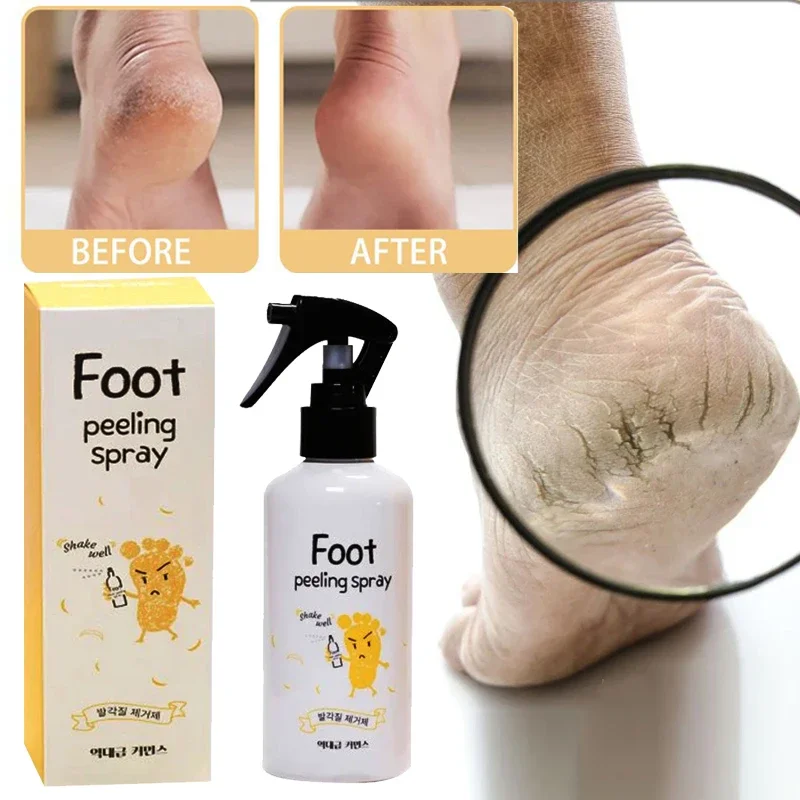 Foot exfoliating repair brightening spray Anti-Drying Crack peeling Treatment Removal Dead Skin calluses feet whiten care liquid