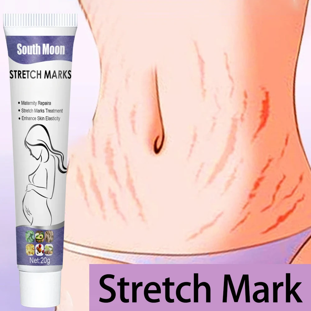 

Remove Stretch Marks Pregnancy Skin Care Improves Elasticity Fade Growth Lines Smoothing Nourishing Moisturizing Firming