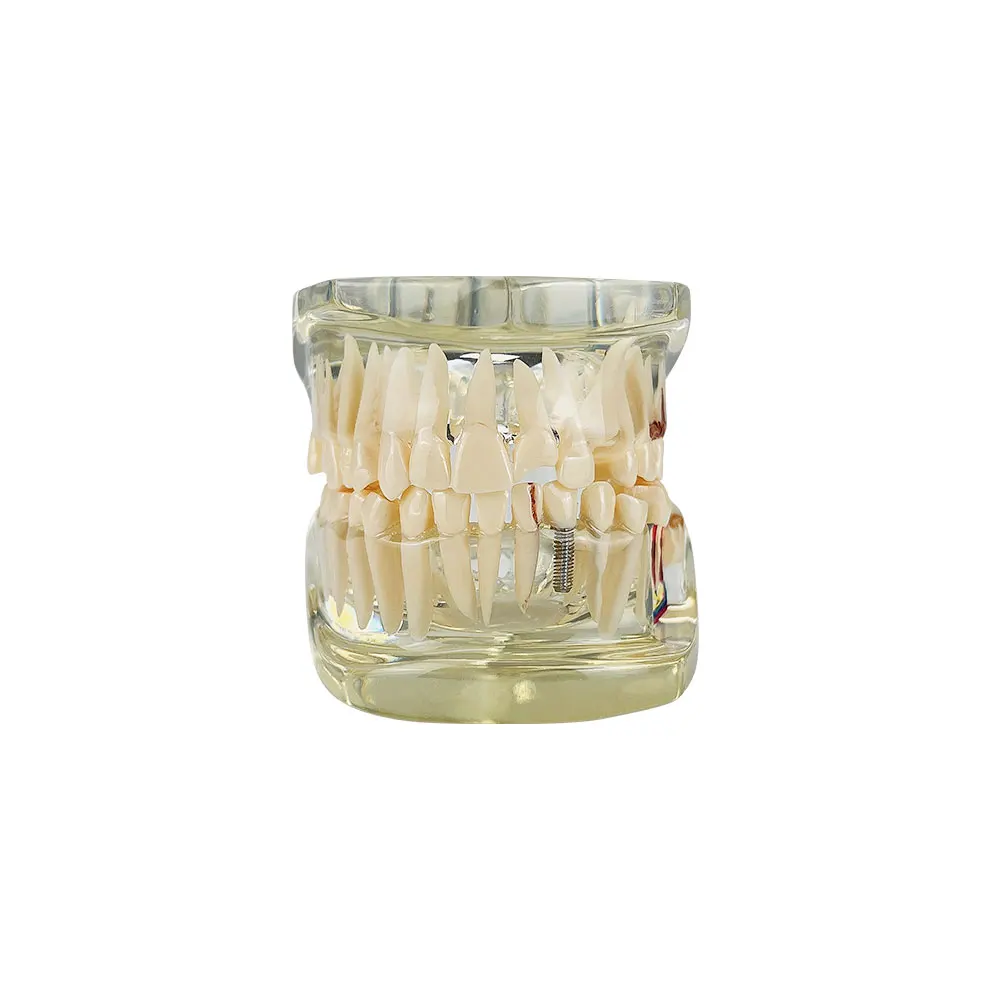 Anatomy Dental Model Teeth Teaching Model Transparent Jaw Model Dentistry Pathology Anatomical Teeth Model For Studying Typodont