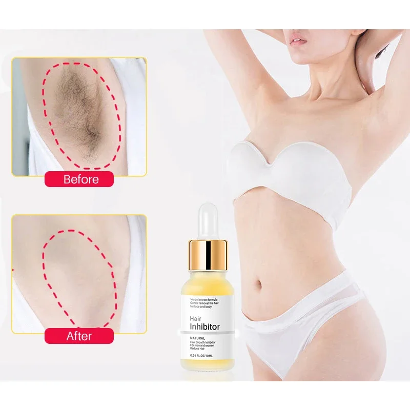 เซรั่มยับยั้งผมถาวรกําจัดขนไม่เจ็บปวดรักแร้ขาแขน Hair Growth Inhibitor Beauty Skin Care Body Essential Oil