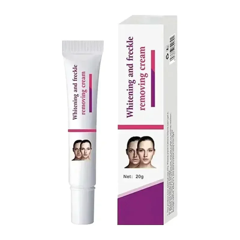 Facial Spots Cream Freckles Removal Skin Dark Spot Remove Melasma Age Spots Sunspots Whitening And Freckle Removing Cream