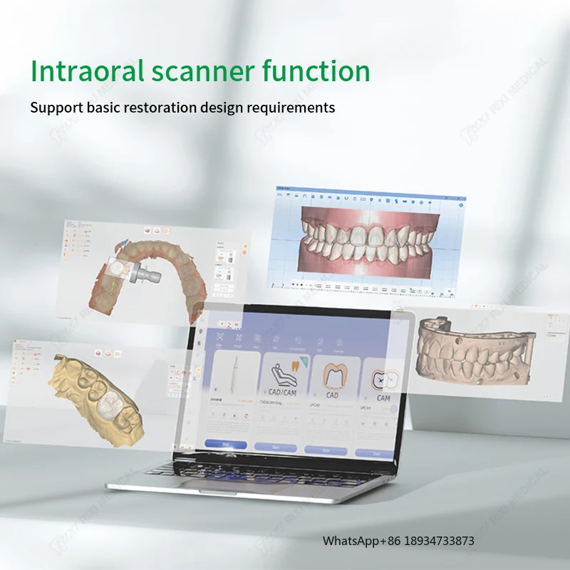 3D Intra Oral Scanner Manufacture High Accuracy Digital Oral Scanner