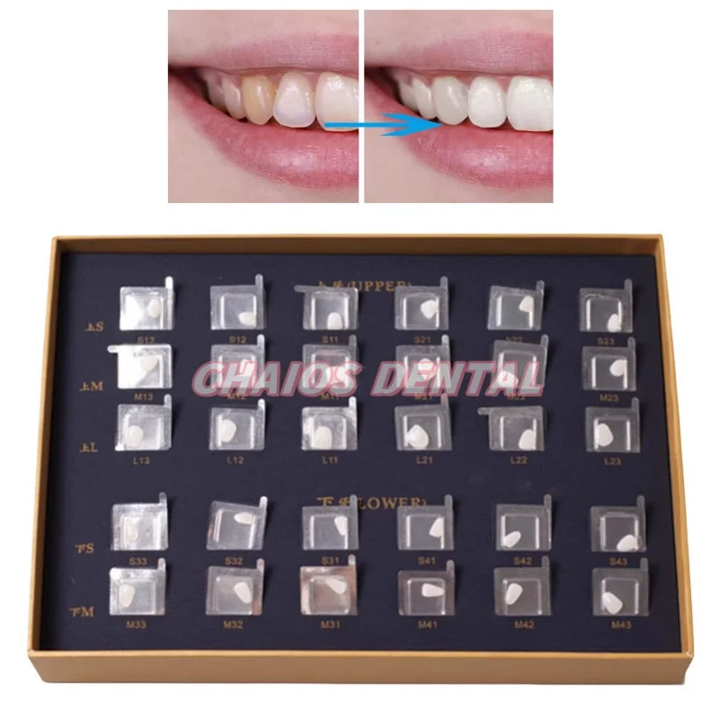 30Pcs/Set Dental Pre-formed Composite Porcelain Veneers Upper/Lower Dental Lab Teeth Whitening Veneers Bright White