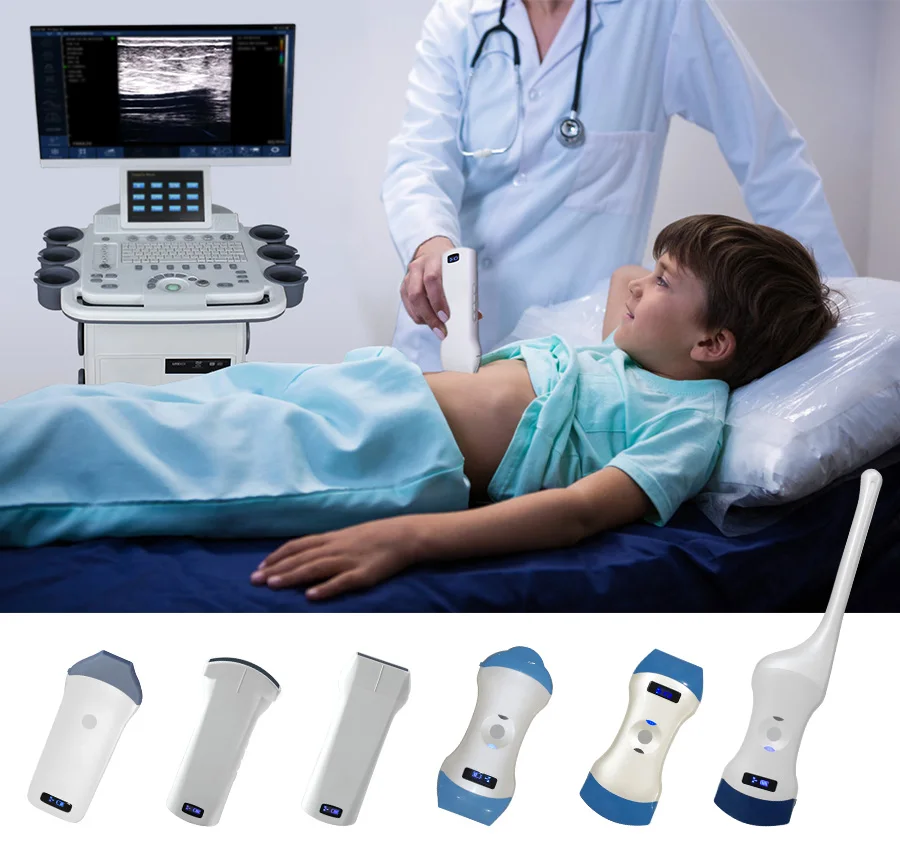 Customized Color Doppler 4D Echo Sonography, Wireless Trolley Doppler Ultrasound