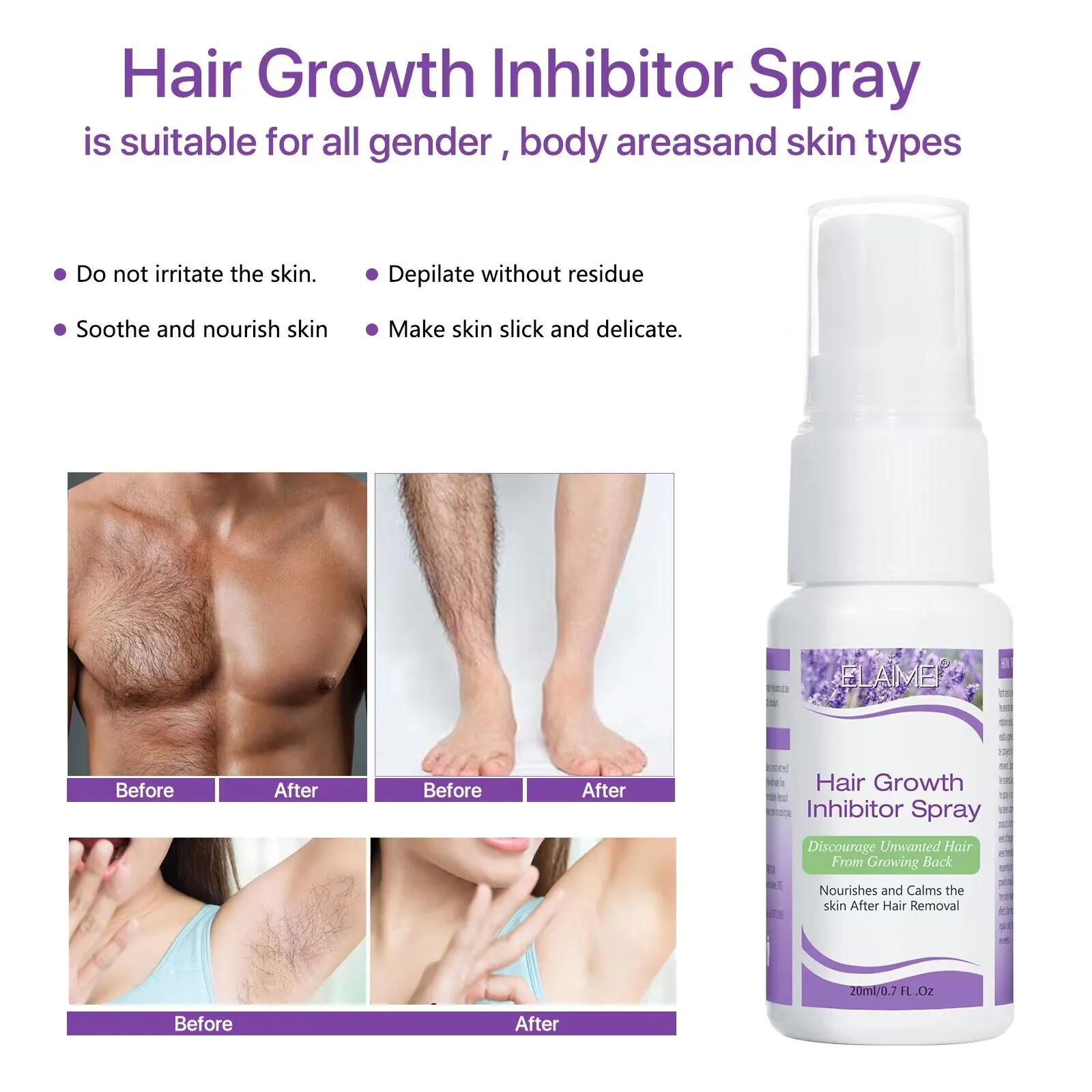 20ML Permanant Hair Growth Removal Inhibitor Spray Beard Bikini Intimate Legs Body Armpit Painless Facial Stop Hair