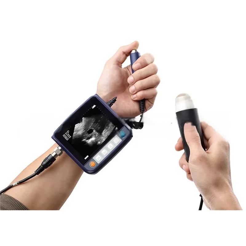 

Portable Full Digital Wrist Veterinary Ultrasound Device for Livestock Monitoring for On-Farm Veterinary Care