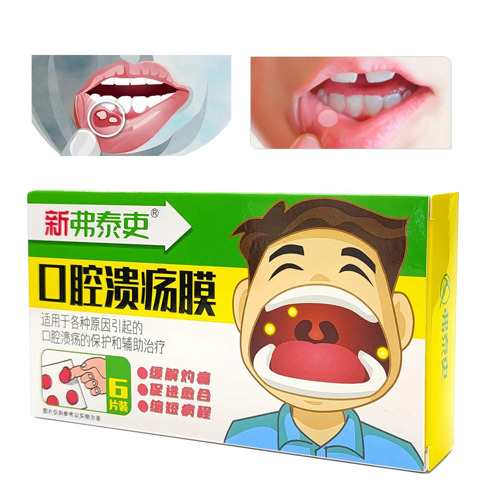 Ifory Mouth Ulcer Patch Antibacterial Spray Film 6Pcs/Box Relief Severe Pain Irritation Canker Sore Cover Oral Ulcer Cream Care