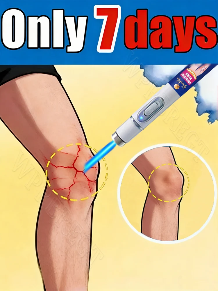 

Unblocking venous problems caused by blood stasis