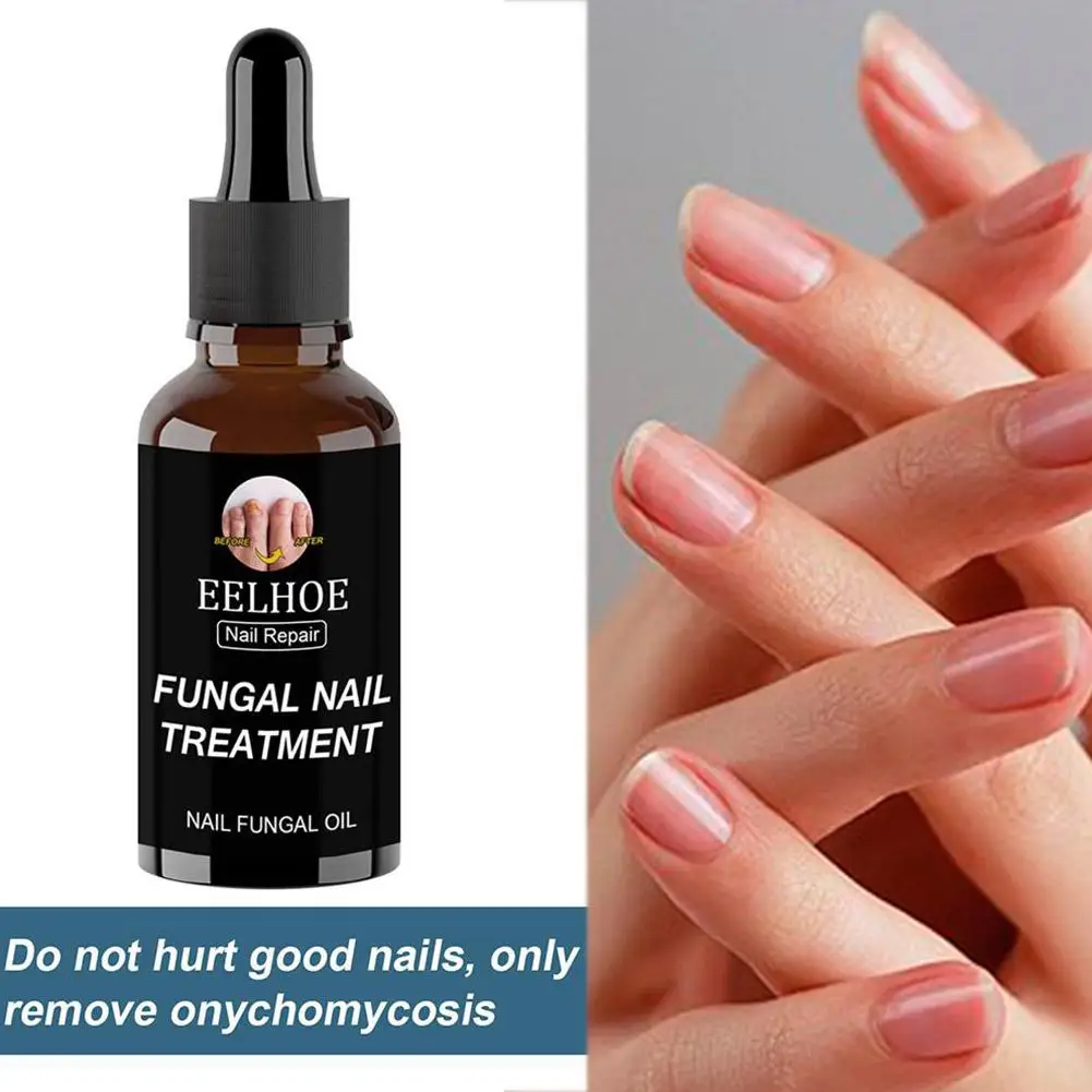 30ml/50ml Nail Nutrition Oil  Nail Treatment Cuticle Revitalizer Oil Prevent Agnail Nail Polish Nourish Skin