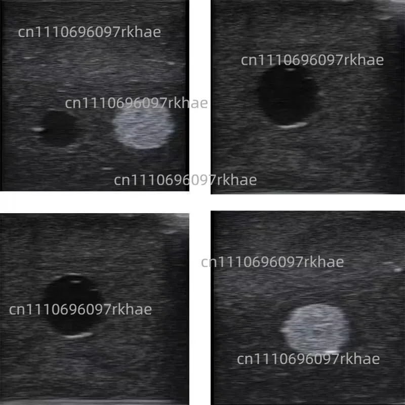 125×95×45mm Ultrasound Puncture Model Tumor Biopsy Training Module