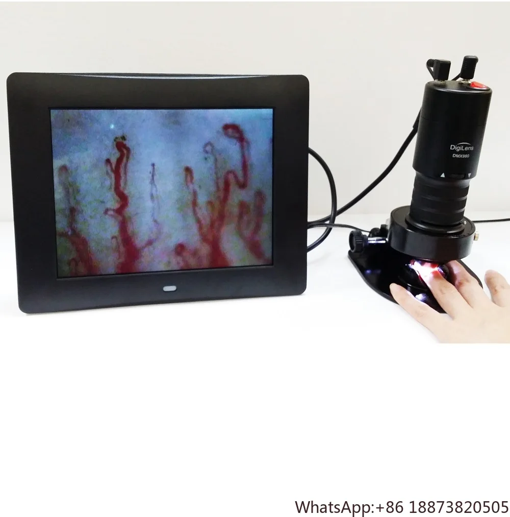 

Capillary Microcirculation Microscope for health