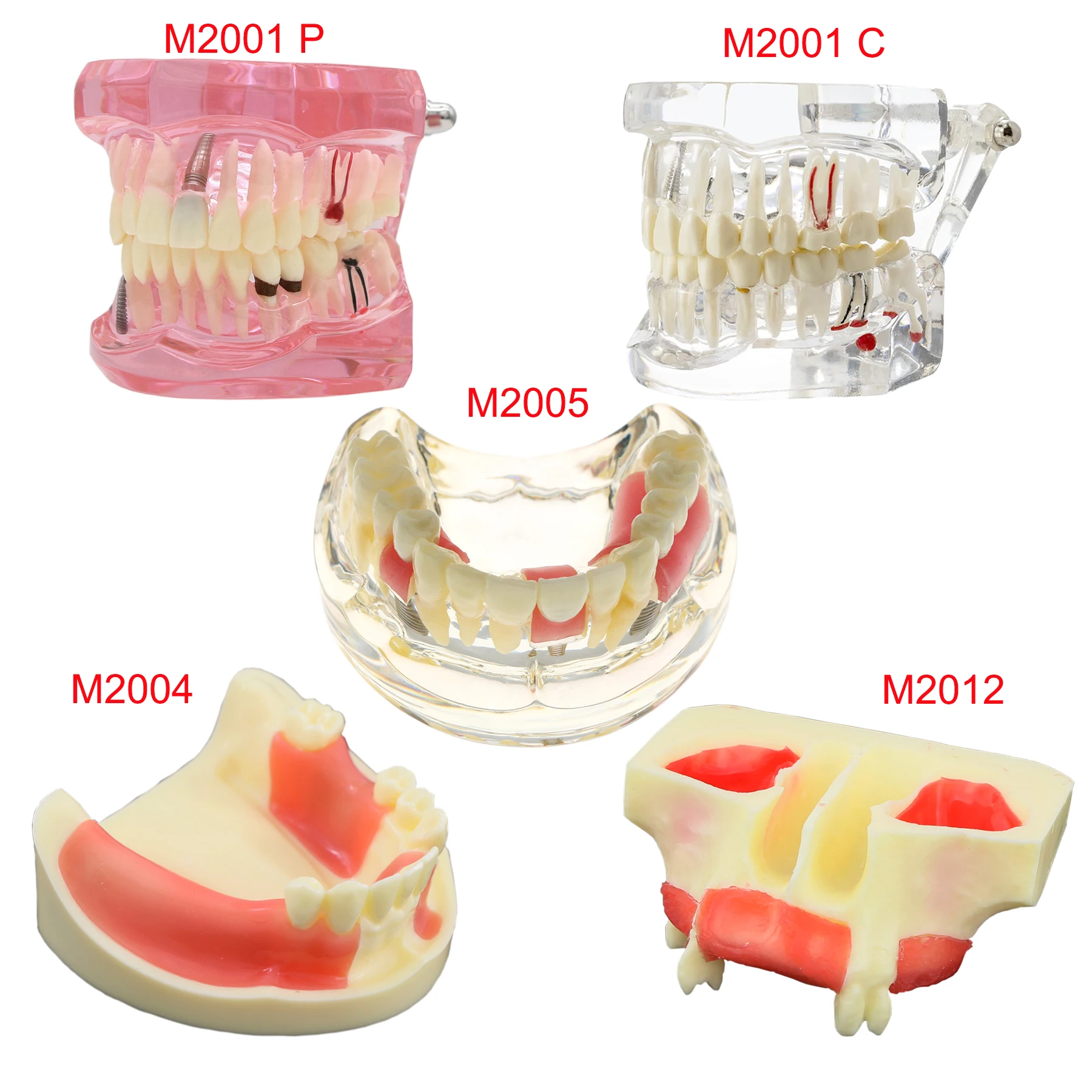 Modelo de dientes dentales, modelo de enseñanza Dental, modelo de implante, modelo de odontología extraíble, para entrenamiento, estudiar, educación