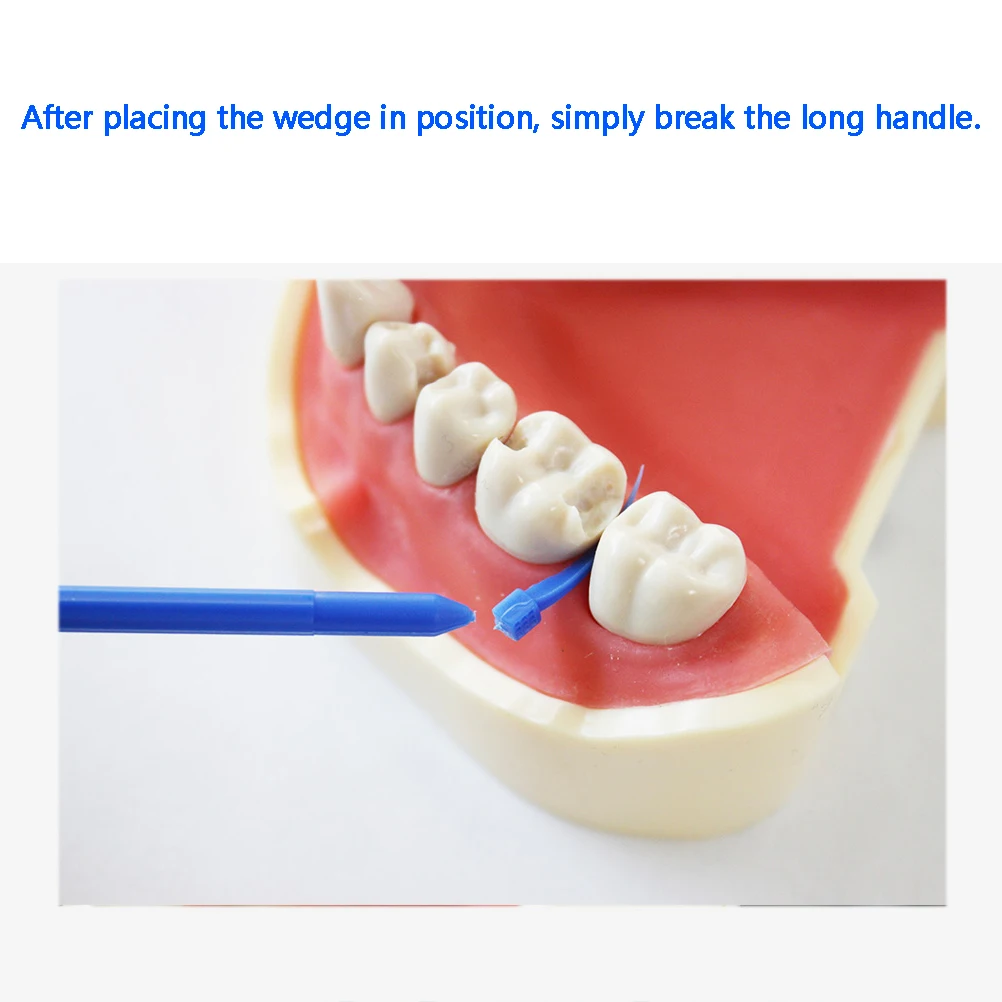 Cotisen Disposable Long Handle Dental Interdental Wedge For Composite Resin Filling Restoration