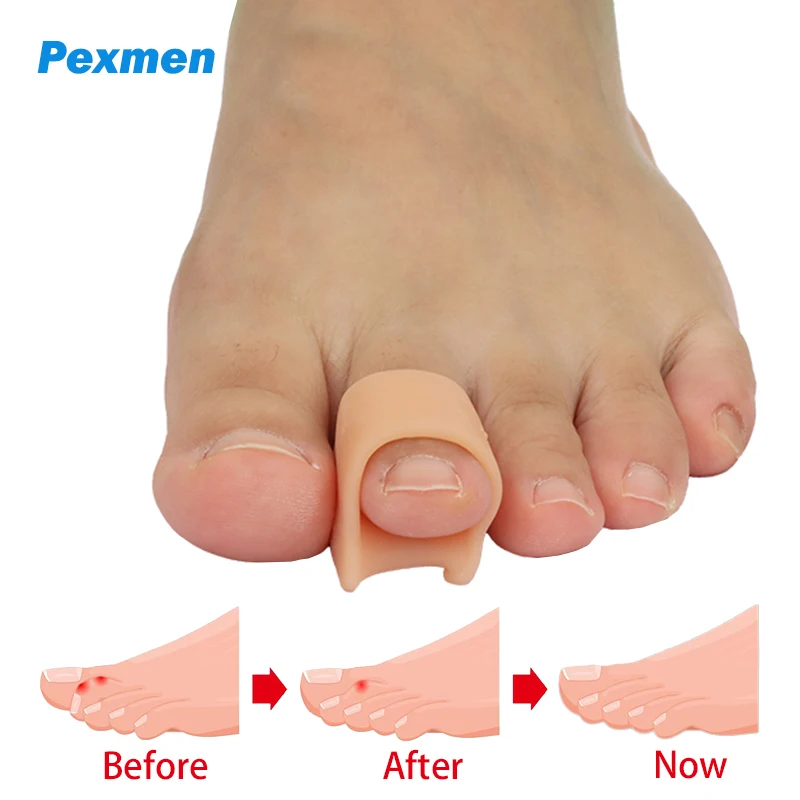 Pexmen 2/4/8Pcs Hammertoe Corrector Toe Splints Soft Gel Toe Straighteners Realign Bent Curled Crooked Claw and Hammer Toes