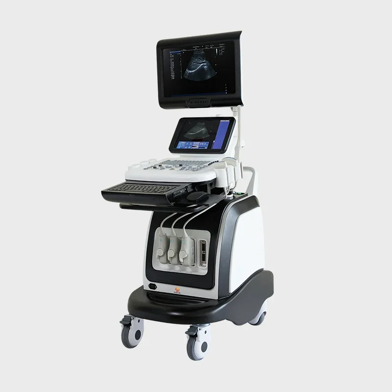 Factory Direct Ultrasound Scanner Ultrasound Machine Price Portable Ultrasound Machine