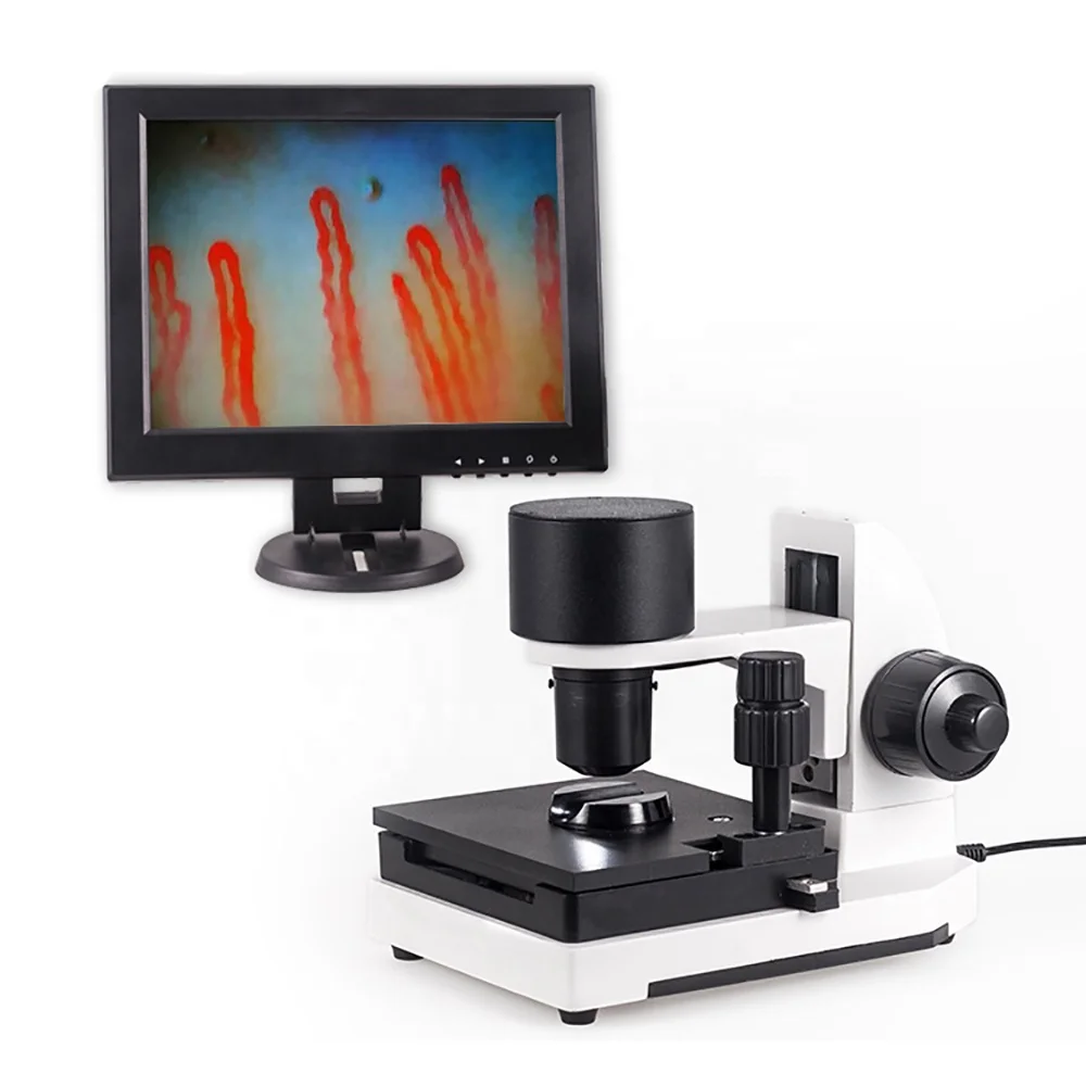 Suyzeko Advanced Nail Checking Microscope nailfold capillaroscopy with 12 inch LCD Screen