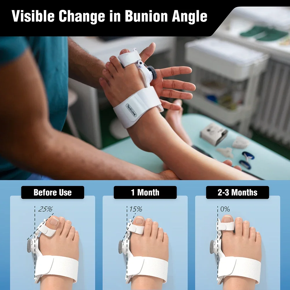 Tenicore 유연한 디자인으로 여행을 위한 최고의 경량 건막류 교정기