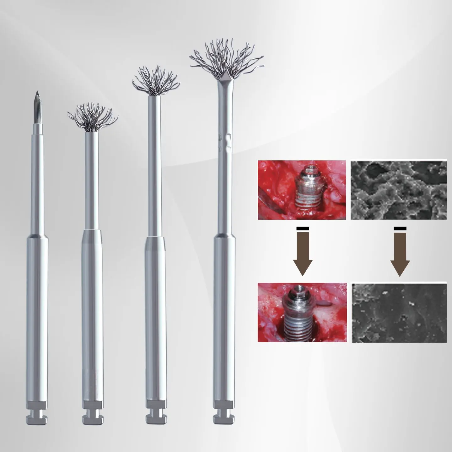 Dental Debridement Peri-Implantitis Implant Surface Threads Titanium Brush for Implant Restoration Maintenance Autoclavable