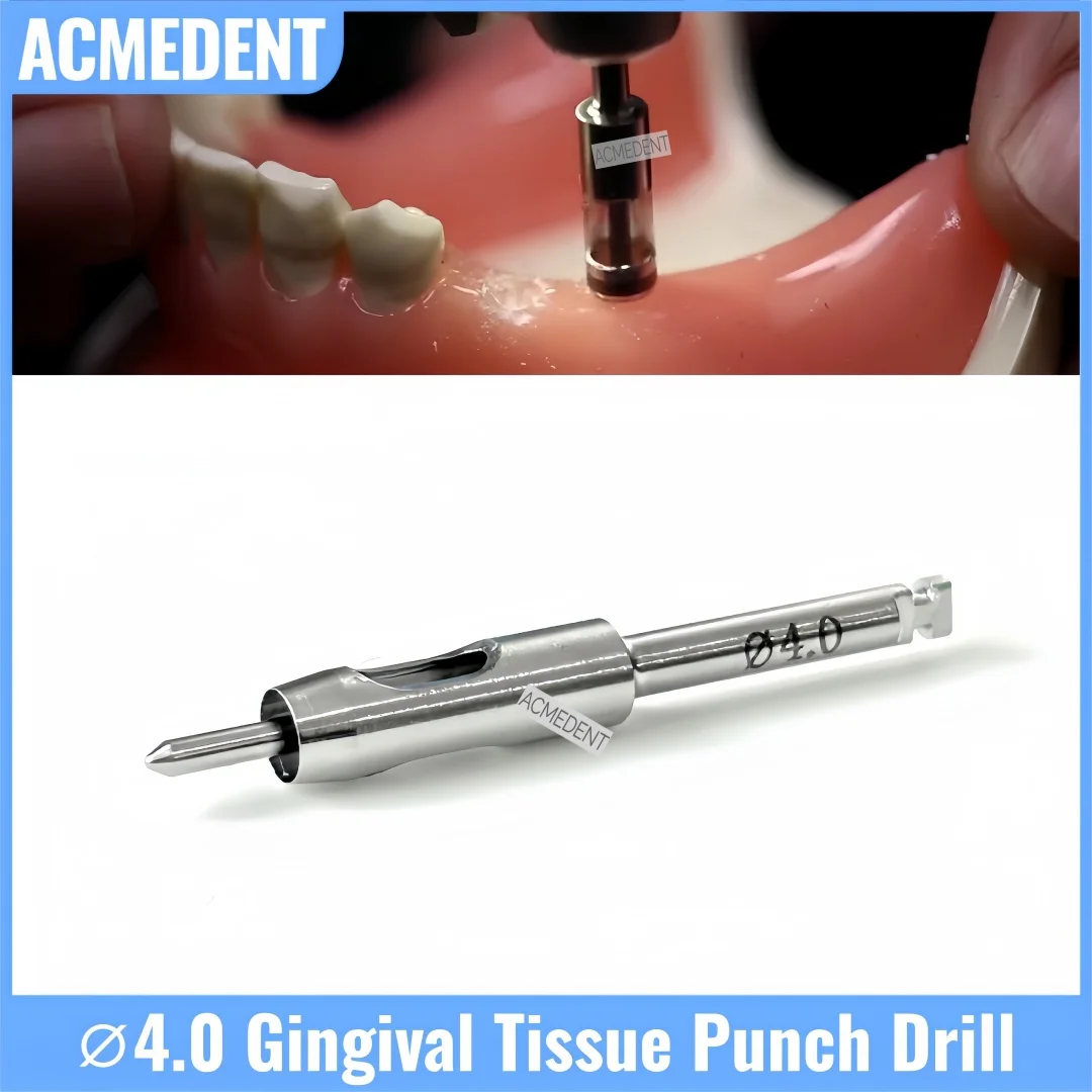 

⌀4.0 Dental Guided Tissue Punch Drill Gingival Cutter Drill With Positioning Guide Pin Handpiece For Flapless Implant Surgery