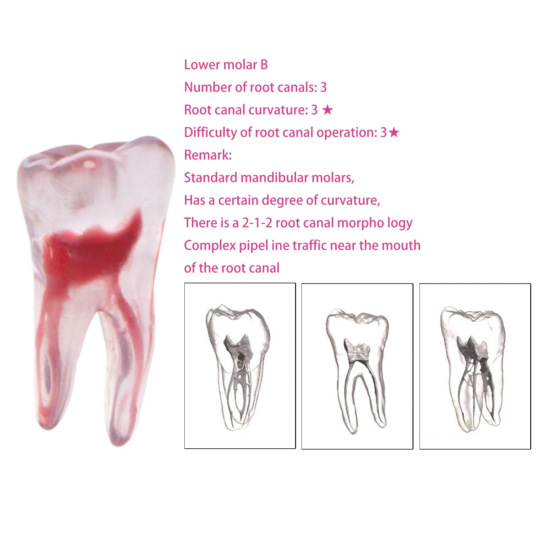 

1/5PCS Dental Root Canal 3D Model Practice Model Lower Molar B Root Canal Therapy Resin Model Endodontics RTC