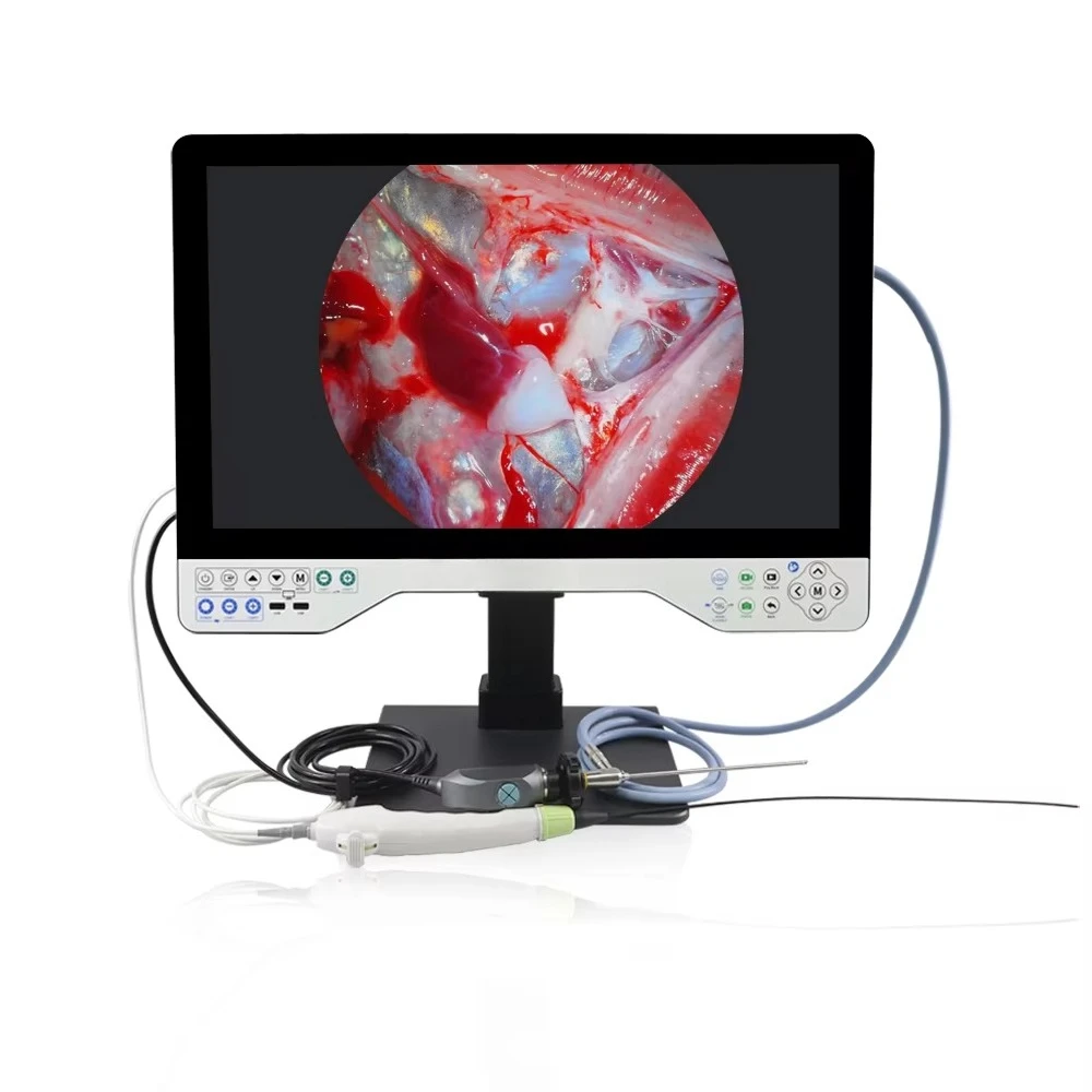 All in One Righid Multi Flexible Endoscopy Camera Full HD Light Source Endoscope Record System for Laparoscopy Uroscopy ENT