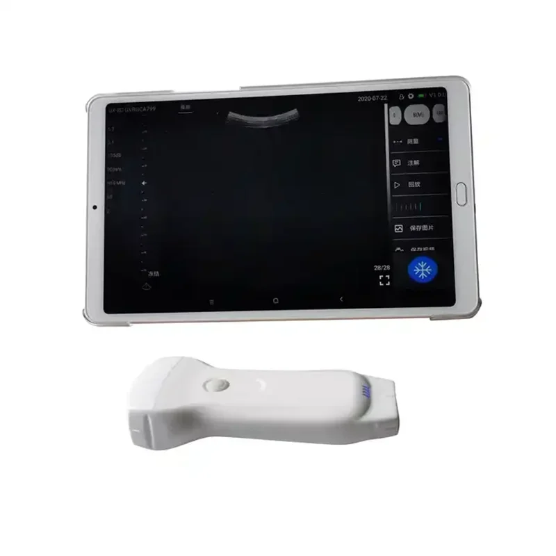 Wireless Android /ios USB Ultrasound Probe Dual Head Ultrasound Scanner 3 in 1 Convex Linear Phased Array Pocket Ultrasound