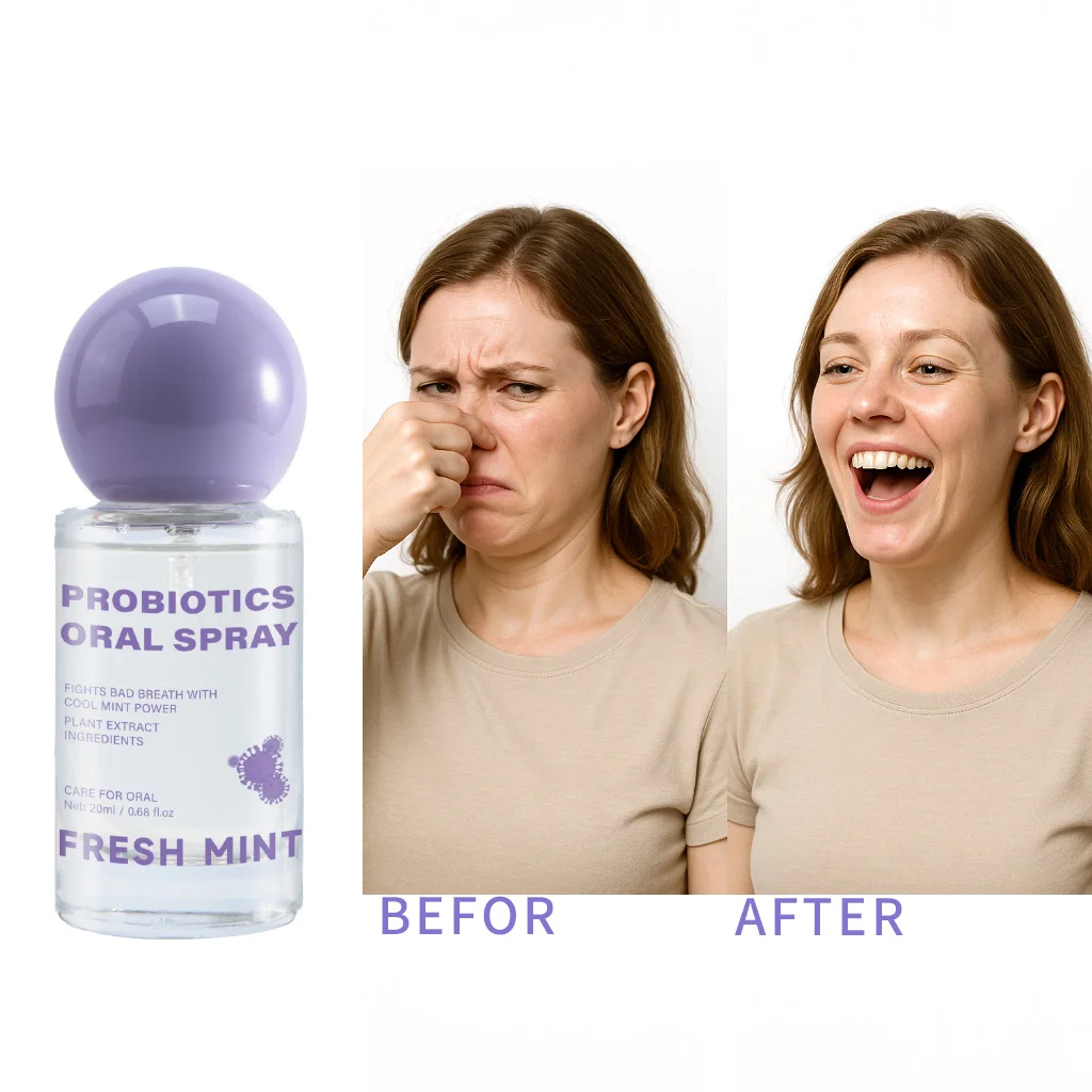 رذاذ فموي طازج يدوم طويلاً معطر فم محمول للبالغين منتجات العناية بالفم نضارة 20 مل #3