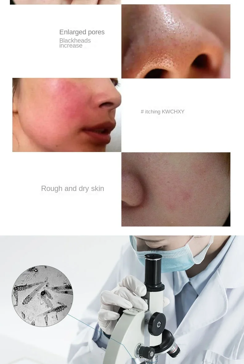 Free Shipping Plasma Ozone Instrument Facial Rejuvenation Insect Acne Marks Skin Mite-Removal Pore Care Beauty Import