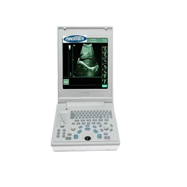 

Mta1c Ultrasound Diagnostic Machine Handheld Colour Doppler Dog Ultrasound Scanner For Vet Hospital/clinic