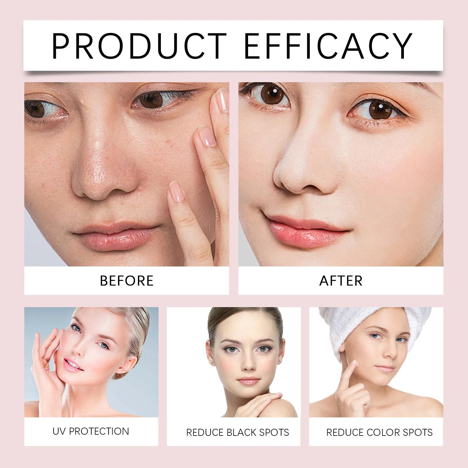 Niacinamide Moisturizing Face and Body Cream for Sensitive Skin Soothing Daily Protection Lotion Non Greasy Soft Skin Care 40g