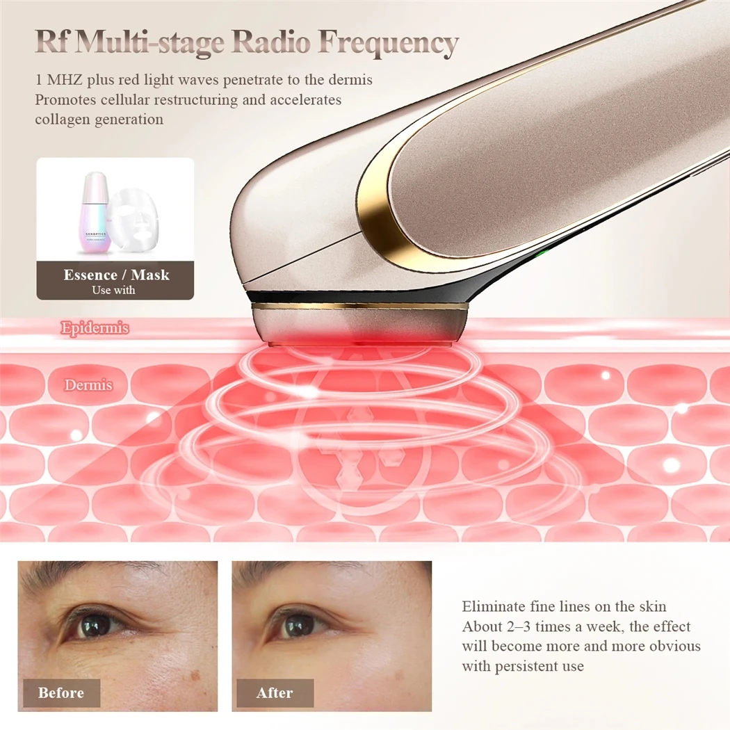 Masajeador de estiramiento Facial EMS para el cuidado de la piel, eliminador de arrugas con fotones LED, compresa caliente RF, dispositivo antienvejecimiento con vibración de 1200Hz