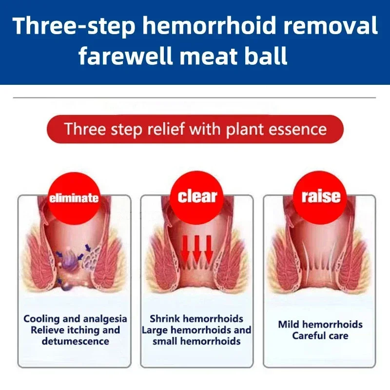 Krim penghilang wasir, salep Gel penghilang ambeien Herbal Internal alami pereda Anus bengkak