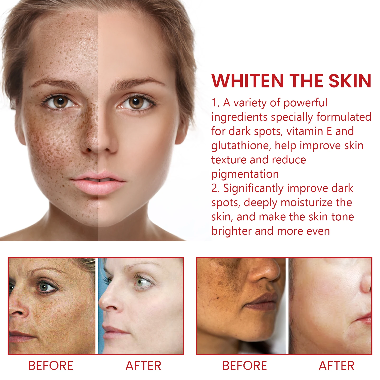 OUHOE Black Spot Repair Cream repairs dull skin, lightens black spots, moisturizes the body and face, and brightens the skin image 3