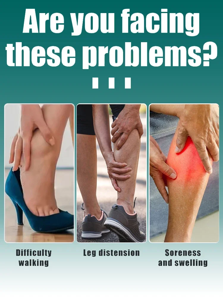 The latest high-tech product of 2026 promotes blood circulation and treats varicose veins.