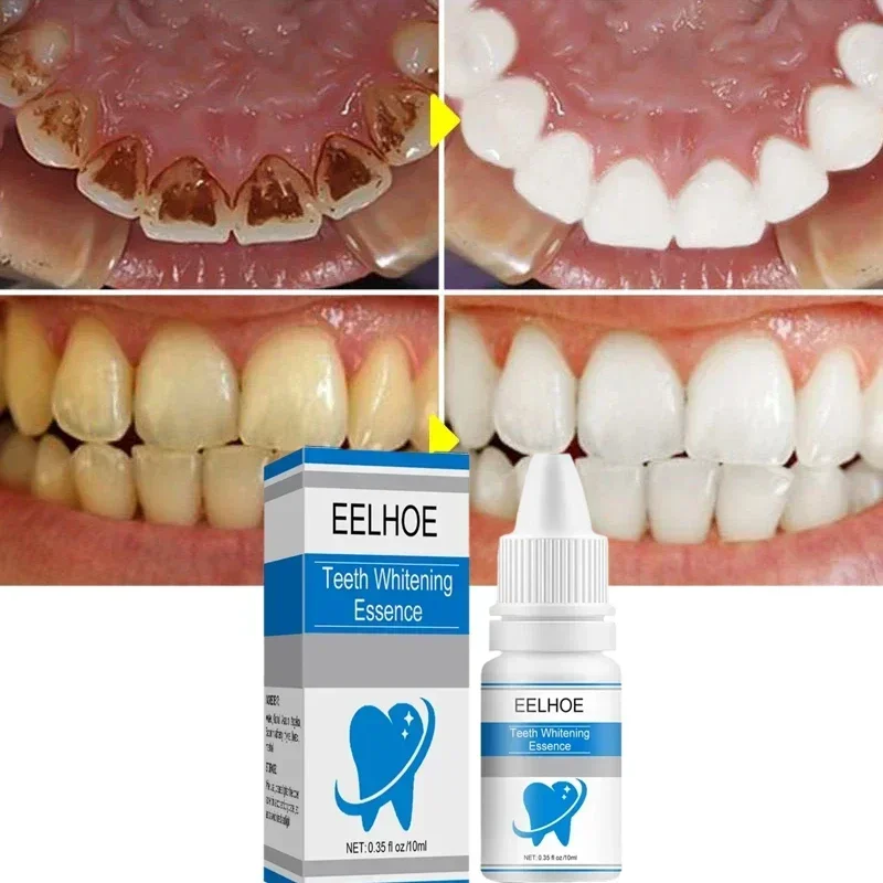 EELHOE Teeth Whitening Essence Remove Plaque Stains Oral Hygiene Bleaching Products Cleansing Fresh Breath Dentistry Care Tools