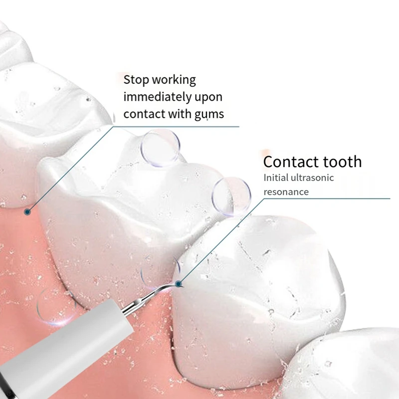 Ultraschall-Scaler für Zähne Zahnstein Fleck Zahnstein entferner elektrische Schall zähne Plaque Reiniger