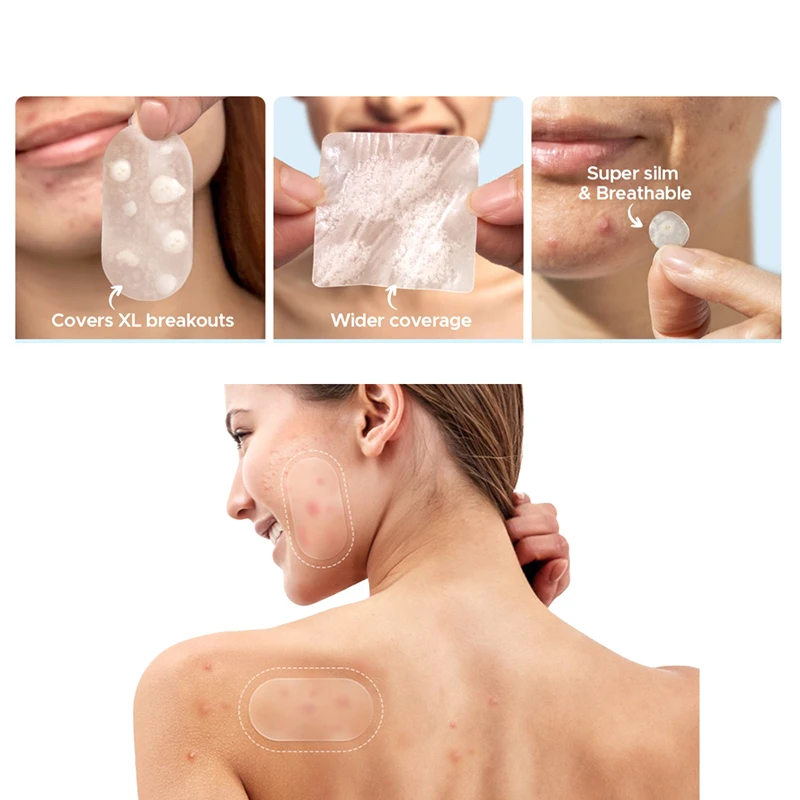 Large Capacity Acne Patch Hydrocolloid Salicylic Transparent Acne Patch Invisible Acne Removal Skin Care Stickers Face Beauty