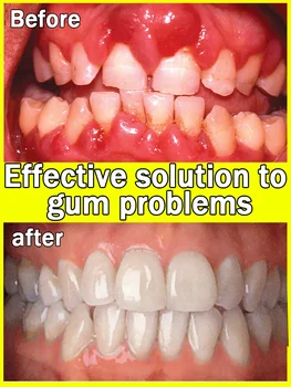 笑顔は歯から始まる