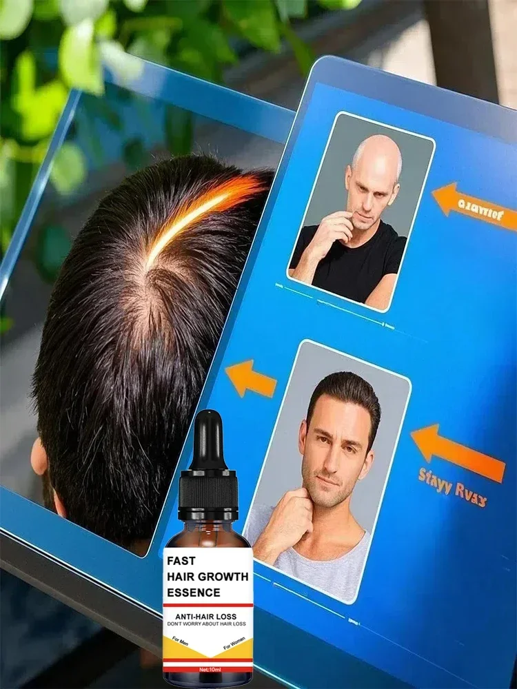 You need a hairstyle!! Hair is getting more and more, say goodbye to baldness, hair becomes thicker, hot selling products.