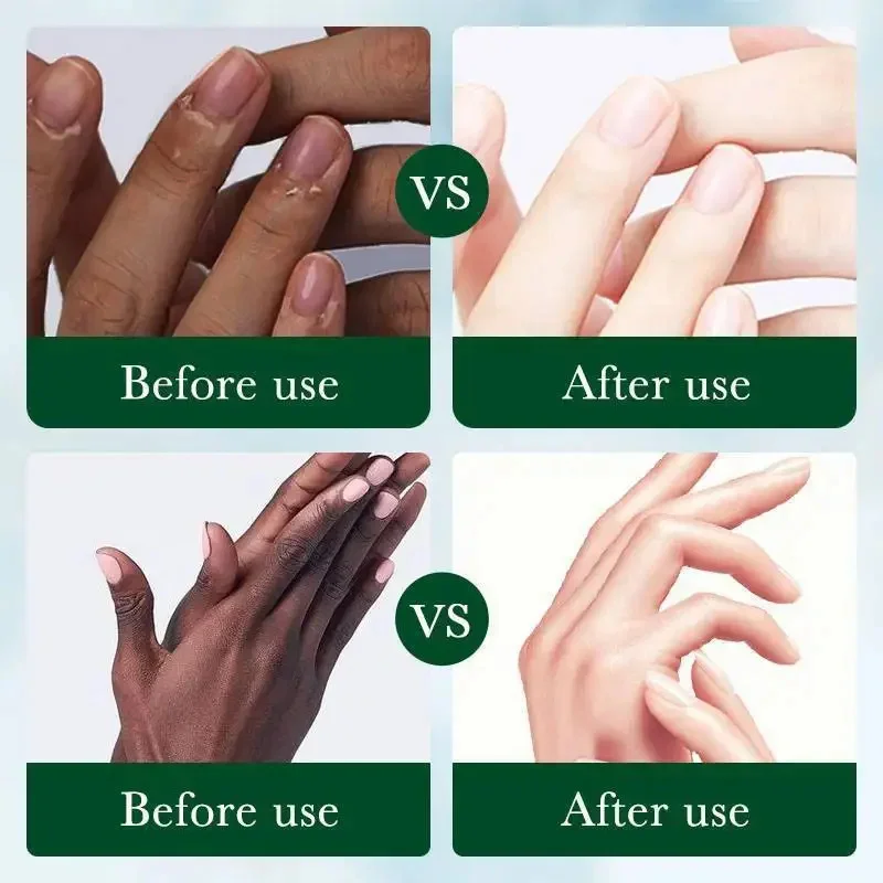 Fast Whitening Dark Knuckles Cream Brighten Hand Cream Lighten Melanin Stains Corrector Hand Anti Crack Soften Moisturize Produc