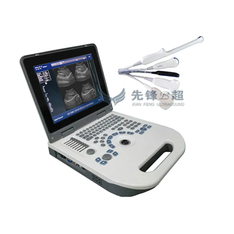 XF50 Full Digital LED Health Treatment Portable Pocket Expert Grade Ultrasound