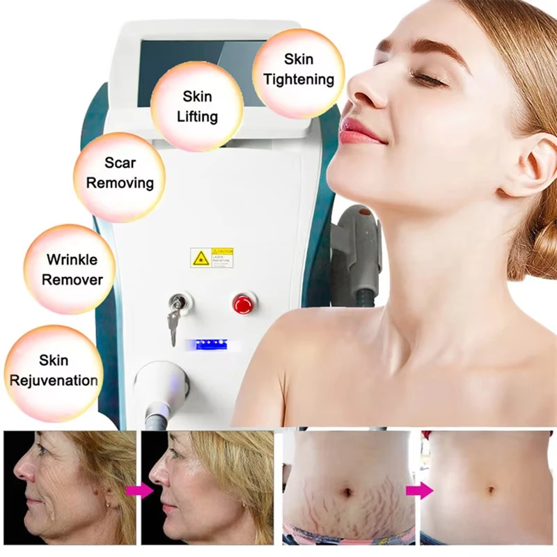 

Портативная лазерная машина Ipl M22, омоложение кожи, профессиональная диодная ледяная титановая лазерная машина для удаления волос на теле, 2025