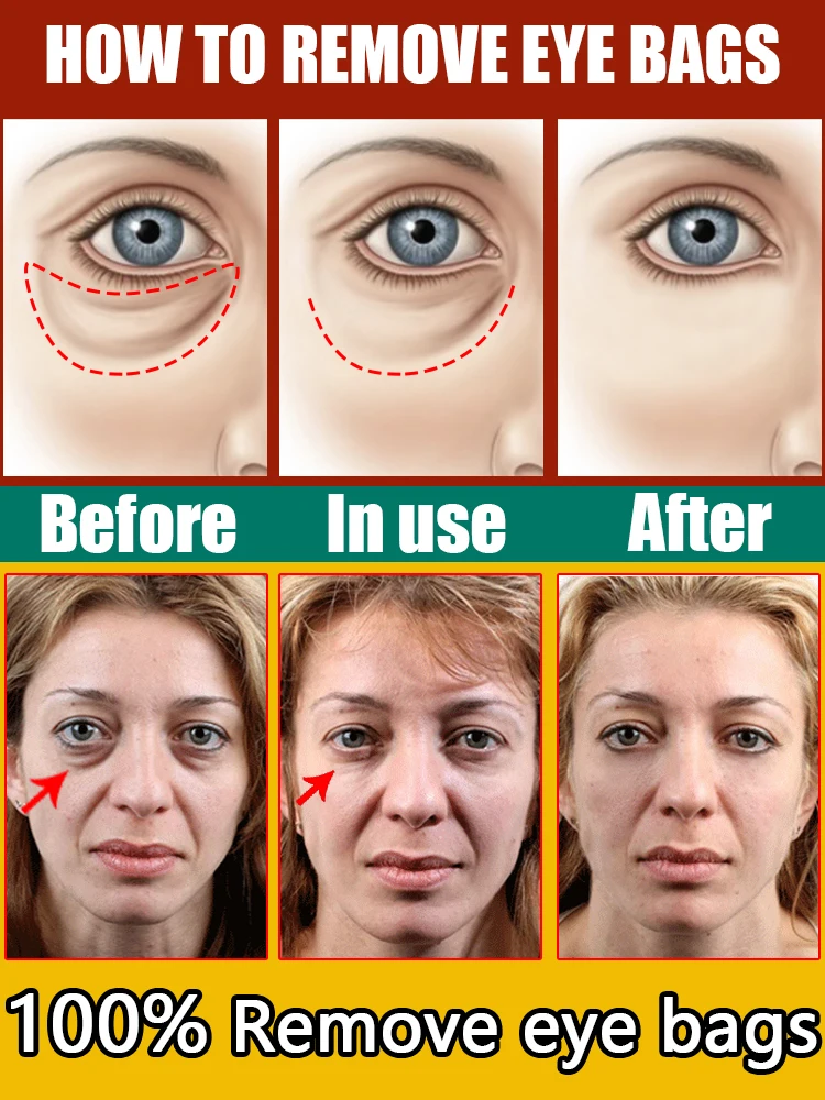 Eye cream Remove bags Puffiness away work under eyes