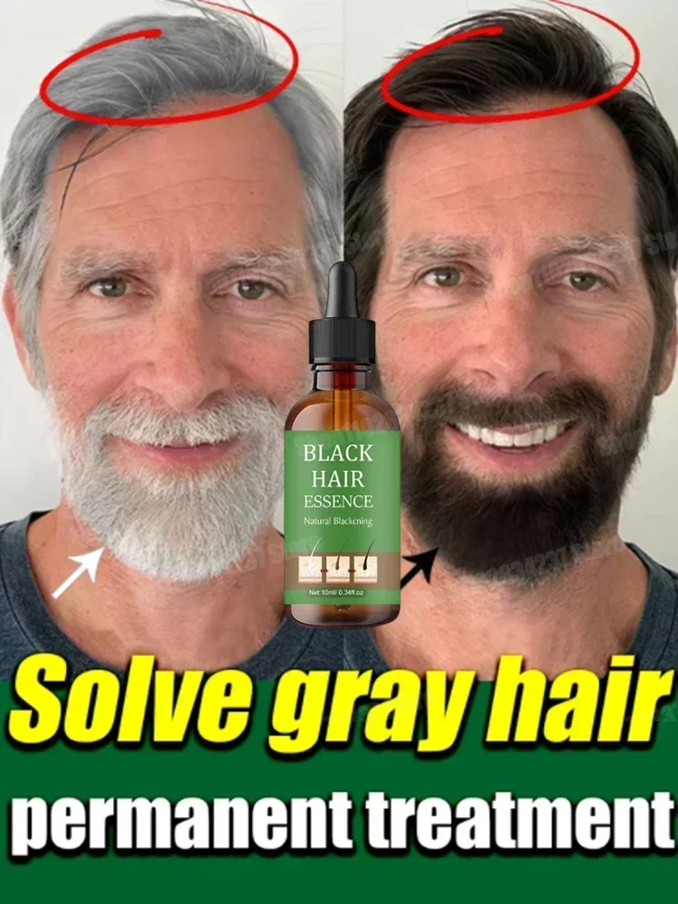 Hot sales White Hair Removal Black growth from the source, anti-white hair growth liquid