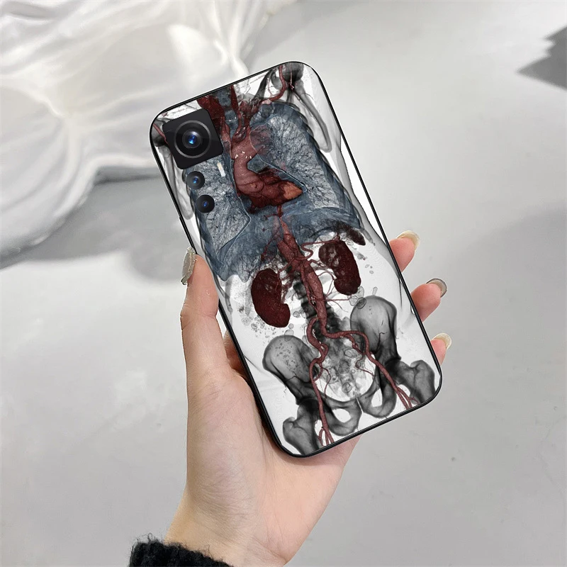 Human Organs Skeleton Skull Brain Case for Xiaomi Mi 11T 11 12T Pro 10T 10 10Pro 12 11 lite 5G NE 12S 10pro Poco X3 Pro Poco F3