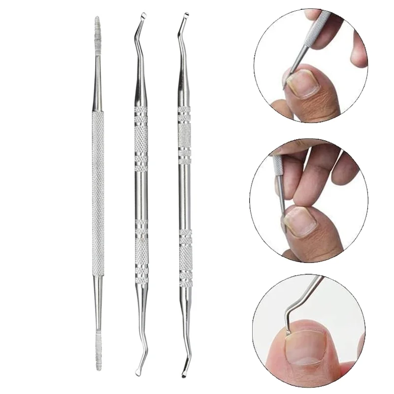 Corretor de unha encravada, clipe de alisamento, levantador de unha, paroníquia, remendo para pés, tratamento de pedicure, ferramenta de cuidados com os pés