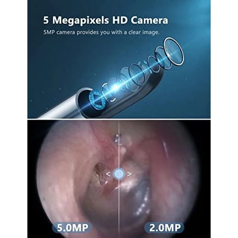 Zmywacz do woskowiny Okulary do uszu z 5-mioliniową kamerą WiFi o wysokiej rozdzielczości Środek do czyszczenia uszu, 6 diod LED, odpowiedni dla
