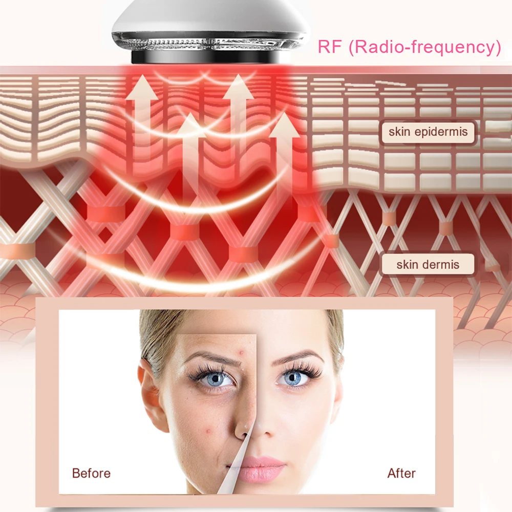 6in1 rosto massageador ems rf infravermelho multifunções instrumento de beleza vibração anti envelhecimento removedor rugas endurecimento beleza cuidados com a pele