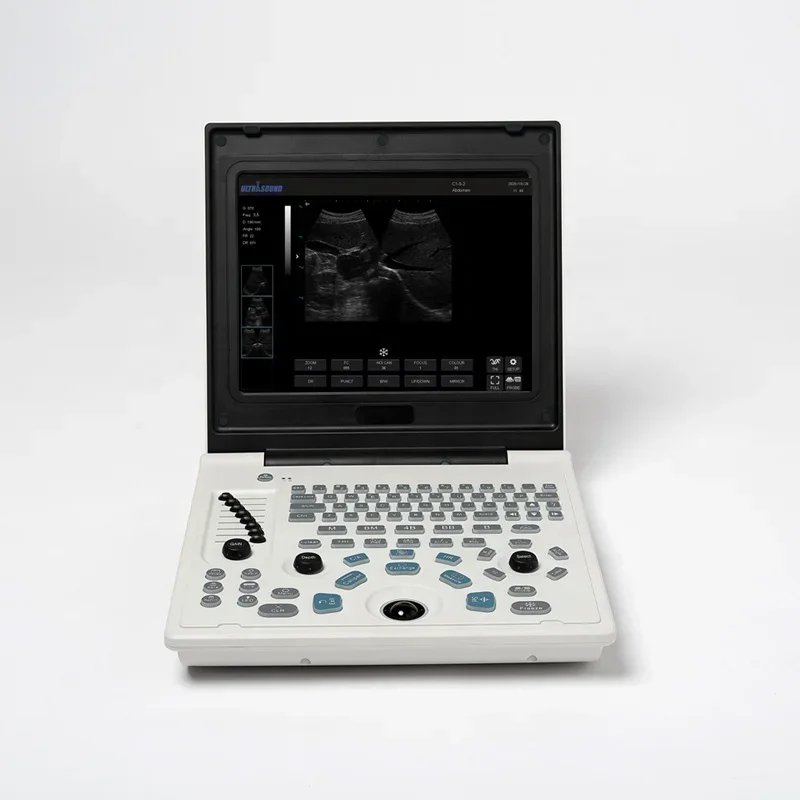

12 Inch Portable Veterinary Ultrasound Machine Animal Ultrasonic Scanner for Medical Diagnostics Animal Health Care