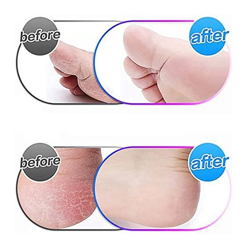 -ABJZ 12 Pack Extra Coarse Replacement Roller For Amope Pedi,Replacement Head Refills Compatible With Amope Pedi Refills